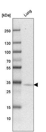 PTPLAD2 Antibody in Western Blot (WB)