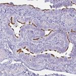 BBS10 Antibody in Immunohistochemistry (IHC)