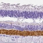 VGAT Antibody in Immunohistochemistry (IHC)