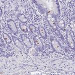 AVIL Antibody in Immunohistochemistry (IHC)