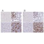 PITPNM3 Antibody in Immunohistochemistry (IHC)