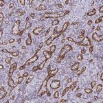 PITPNM3 Antibody in Immunohistochemistry (IHC)