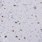 BEX5 Antibody in Immunohistochemistry (IHC)