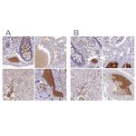 HGF Activator Antibody in Immunohistochemistry (IHC)