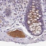 HGF Activator Antibody in Immunohistochemistry (IHC)