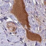 HGF Activator Antibody in Immunohistochemistry (IHC)