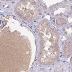 HGF Activator Antibody in Immunohistochemistry (IHC)