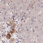 HGF Activator Antibody in Immunohistochemistry (IHC)