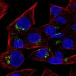 RAB6A Antibody in Immunocytochemistry (ICC/IF)