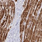 NDUFA7 Antibody in Immunohistochemistry (IHC)