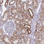 NDUFA7 Antibody in Immunohistochemistry (IHC)