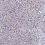 NDUFA7 Antibody in Immunohistochemistry (IHC)