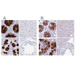 CLCA1 Antibody in Immunohistochemistry (IHC)