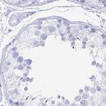 CLCA1 Antibody in Immunohistochemistry (IHC)