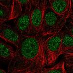 ZDHHC12 Antibody in Immunocytochemistry (ICC/IF)