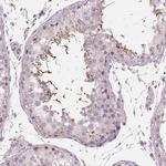 ADAM20 Antibody in Immunohistochemistry (IHC)