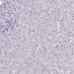 TTC7B Antibody in Immunohistochemistry (IHC)