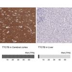 TTC7B Antibody