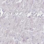 MYLK2 Antibody in Immunohistochemistry (IHC)