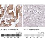 MYLK2 Antibody in Immunohistochemistry (IHC)