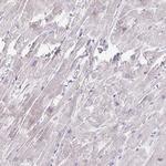 MYLK2 Antibody in Immunohistochemistry (IHC)