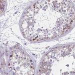 GIGYF2 Antibody in Immunohistochemistry (IHC)