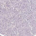 TREF1 Antibody in Immunohistochemistry (IHC)