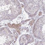 ZSCAN9 Antibody in Immunohistochemistry (IHC)