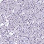 VGAT Antibody in Immunohistochemistry (IHC)