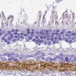 VGAT Antibody in Immunohistochemistry (IHC)