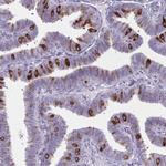 PITPNM1 Antibody in Immunohistochemistry (IHC)