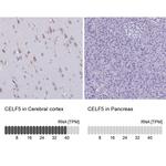 BRUNOL5 Antibody in Immunohistochemistry (IHC)