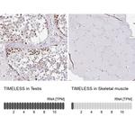 TIMELESS Antibody in Immunohistochemistry (IHC)