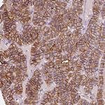 SLC7A8 Antibody in Immunohistochemistry (IHC)