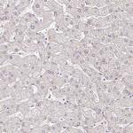 EHF Antibody in Immunohistochemistry (IHC)