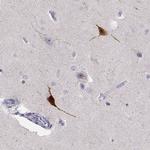 YJEFN3 Antibody in Immunohistochemistry (IHC)