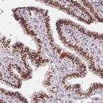 CD2BP2 Antibody in Immunohistochemistry (IHC)