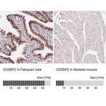 CD2BP2 Antibody