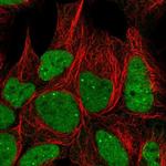 GTF3C6 Antibody in Immunocytochemistry (ICC/IF)