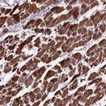 OXCT1 Antibody in Immunohistochemistry (IHC)