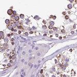 OXCT1 Antibody in Immunohistochemistry (IHC)