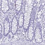 Cystatin D Antibody in Immunohistochemistry (IHC)