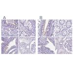 Enkurin Antibody in Immunohistochemistry (IHC)