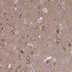 DYNC1I1 Antibody in Immunohistochemistry (IHC)