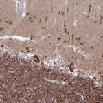 DYNC1I1 Antibody in Immunohistochemistry (IHC)