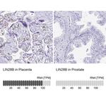 LIN28B Antibody in Immunohistochemistry (IHC)