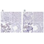 LIN28B Antibody in Immunohistochemistry (IHC)