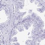 LIN28B Antibody in Immunohistochemistry (IHC)