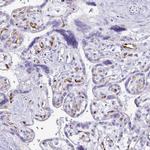 LIN28B Antibody in Immunohistochemistry (IHC)