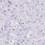 LIN28B Antibody in Immunohistochemistry (IHC)